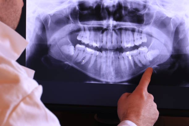 Best Cracked Tooth Emergency Dentist  in Totowa, NJ