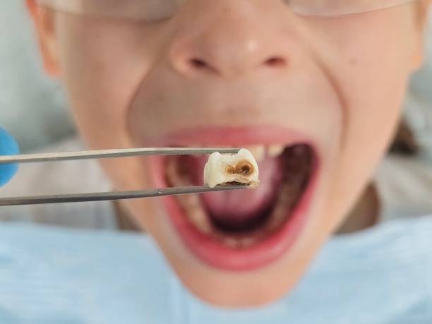 Best Tooth Infection Emergency Dentist  in Totowa, NJ