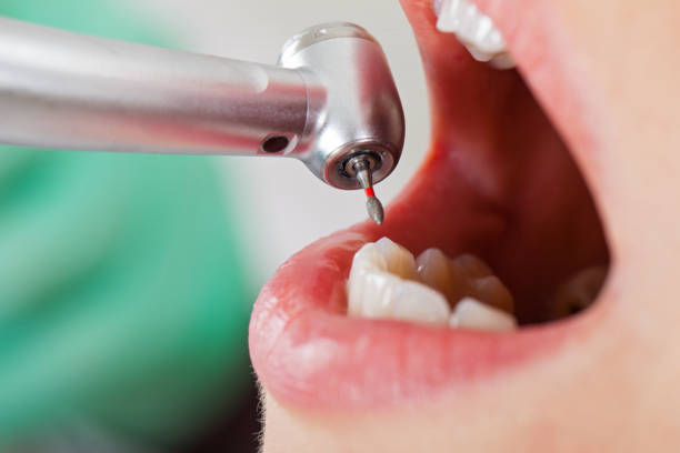 Best Urgent Tooth Repair  in Totowa, NJ